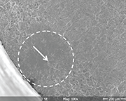 Figure 5: Fatigue fracture surface (SEM) of condition carburized + shot peened (circle indicates crack nucleation (arrow) and region of early crack propagation below the surface)