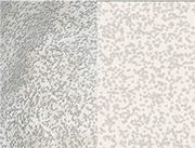 Picture 12: Aluminum surface after 50% coverage; real microscope picture (left) and artificial picture from PA