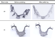 Figure 3. Visual inspection of the CoCr-RPDs before and after being polished by using the DLyte® Technology