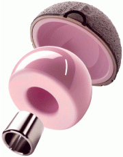 Photo 3: Ceramic implants (picture: Femoral head and acetabular cup) are one of the fastest growing segments of orthopedic implants